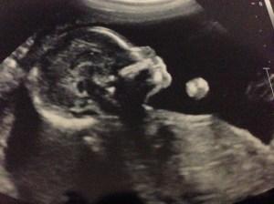 BabyUltrasound1