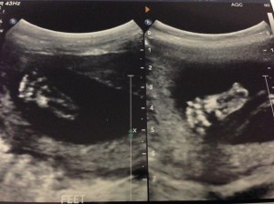 BabyUltrasound2